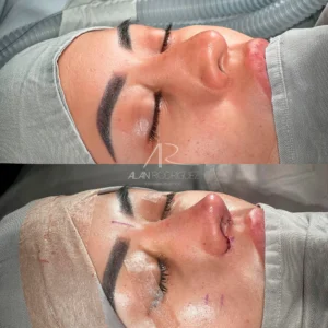 Post 2_converted